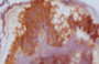 Immunohistochemistry of paraffin-embedded human tonsil tissue using CAC10711 at dilution of 1:100