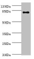 Western blot; All lanes: GBE1 antibody at 3.13µg/ml + Mouse liver tissue; Secondary; Goat polyclonal to rabbit IgG at 1/10000 dilution; predicted band size 80 kDa; Observed band size: 80 kDa;