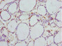 Immunohistochemistry of paraffin-embedded human thyroid tissue using CAC10717 at dilution of 1:100