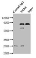 Immunoprecipitating TARS in A549 whole cell lysate; , Lane 1: Rabbit control IgG instead in A549 whole cell lysate. For western blotting, a HRP-conjugated Protein G antibody was used as the secondary antibody (1/2000); , Lane 2: CAC10739 (8µg) + A549 whole cell lysate (500µg); , Lane 3: A549 whole cell lysate (10µg)