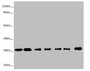 Western blot; All lanes: RALB antibody at 1.26µg/ml; Lane 1: Mouse brain tissue; Lane 2: Mouse lung tissue; Lane 3: MCF-7 whole cell lysate; Lane 4: HepG2 whole cell lysate; Lane 5: Jurkat whole cell lysate; Lane 6: NIH/3T3 whole cell lysate; Lane 7: Hela whole cell lysate; Secondary; Goat polyclonal to rabbit IgG at 1/10000 dilution; Predicted band size: 24, 26 kDa; Observed band size: 26 kDa