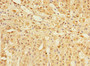 Immunohistochemistry of paraffin-embedded human adrenal gland tissue using CAC10746 at dilution of 1:100