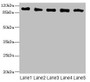 Western blot; All lanes: COPB2 antibody at 2.51µg/ml; Lane 1: Human placenta tissue; Lane 2: MCF-7 whole cell lysate; Lane 3: Hela whole cell lysate; Lane 4: HepG2 whole cell lysate; Lane 5: Jurkat whole cell lysate; Secondary; Goat polyclonal to rabbit IgG at 1/10000 dilution; Predicted band size: 103, 100 kDa; Observed band size: 103 kDa;