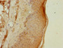 Immunohistochemistry of paraffin-embedded human skin tissue using CAC10749 at dilution of 1:100