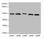 Western blot; All lanes: PSMD13antibody at 3.42µg/ml; Lane 1: Mouse lung tissue; Lane 2: 293T whole cell lysate; Lane 3: Hela whole cell lysate; Lane 4: HepG2 whole cell lysate; Lane 5: Jurkat whole cell lysate; Secondary; Goat polyclonal to rabbit IgG at 1/10000 dilution; Predicted band size: 43 kDa; Observed band size: 43 kDa;