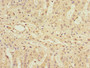 Immunohistochemistry of paraffin-embedded human adrenal gland tissue using CAC10750 at dilution of 1:100