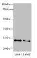 Western blot; All lanes: RRAS2 antibody at 2.66µg/ml; Lane 1: NIH/3T3 whole cell lysate; Lane 2: A431 whole cell lysate; Secondary; Goat polyclonal to rabbit IgG at 1/10000 dilution; Predicted band size: 24, 16, 20, 25 kDa; Observed band size: 24 kDa