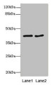 Western blot; All lanes: MTCH1antibody at 2.32µg/ml; Lane 1: MCF-7 whole cell lysate; Lane 2: HepG2 whole cell lysate; Secondary; Goat polyclonal to rabbit IgG at 1/10000 dilution; Predicted band size: 42, 40, 20 kDa; Observed band size: 42 kDa;