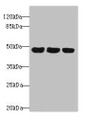 Western blot; All lanes: TXNDC5 antibody at 4.9µg/ml; Lane 1: HepG2 whole cell lysate; Lane 2: Colo320 whole cell lysate; Lane 3: Mouse stomach tissue; Secondary; Goat polyclonal to rabbit IgG at 1/10000 dilution; Predicted band size: 48, 37 kDa; Observed band size: 48 kDa;