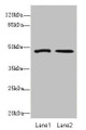 Western blot; All lanes: GCM1antibody at 1.67µg/ml; Lane 1: Hela whole cell lysate; Lane 2: HepG2 whole cell lysate; Secondary; Goat polyclonal to rabbit IgG at 1/10000 dilution; Predicted band size: 49 kDa; Observed band size: 49 kDa;