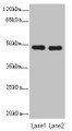Western blot; All lanes: GCM1antibody at 0.97µg/ml; Lane 1: Hela whole cell lysate; Lane 2: HepG2 whole cell lysate; Secondary; Goat polyclonal to rabbit IgG at 1/10000 dilution; Predicted band size: 49 kDa; Observed band size: 49 kDa;
