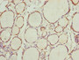 Immunohistochemistry of paraffin-embedded human thyroid tissue using CAC10760 at dilution of 1:100
