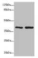Western blot; All lanes: PDCD2L antibody at 1.69µg/ml; Lane 1: Hela whole cell lysate; Lane 2: MCF-7 whole cell lysate; Secondary; Goat polyclonal to rabbit IgG at 1/10000 dilution; Predicted band size: 39 kDa; Observed band size: 39 kDa