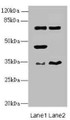 Western blot; All lanes: EHF antibody at 4.95µg/ml; Lane 1: Mouse brain tissue; Lane 2: Mouse lung tissue; Secondary; Goat polyclonal to rabbit IgG at 1/10000 dilution; Predicted band size: 35, 33, 38 kDa; Observed band size: 35, 45, 63 kDa;