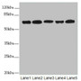 Western blot; All lanes: ELF2 antibody at 2.27µg/ml; Lane 1: HL60 whole cell lysate; Lane 2: A549 whole cell lysate; Lane 3: MCF-7 whole cell lysate; Lane 4: Jurkat whole cell lysate; Lane 5: Hela whole cell lysate; Secondary; Goat polyclonal to rabbit IgG at 1/10000 dilution; Predicted band size: 64, 63, 57, 58, 55 kDa; Observed band size: 64, 50 kDa;