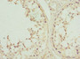 Immunohistochemistry of paraffin-embedded human testis tissue using CAC10771 at dilution of 1:100