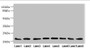 Western blot; All lanes: RAB23 antibody at 3.88µg/ml; Lane 1: Mouse ocular tissue; Lane 2: Rat brain tissue; Lane 3: Mouse kidney tissue; Lane 4: Mouse lung tissue; Lane 5: Mouse brain tissue; Lane 6: NIH/3T3 whole cell lysate; Lane 7: MCF-7 whole cell lysate; Lane 8: Hela whole cell lysate; Secondary; Goat polyclonal to rabbit IgG at 1/10000 dilution; Predicted band size: 27 kDa; Observed band size: 27 kDa;