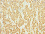 Immunohistochemistry of paraffin-embedded human adrenal gland tissue using CAC10777 at dilution of 1:100