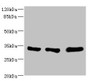 Western blot; All lanes: EIF2B1 antibody at 5.14µg/ml; Lane 1: K562 whole cell lysate; Lane 2: Mouse brain tissue; Lane 3: Jurkat whole cell lysate; Secondary; Goat polyclonal to rabbit IgG at 1/10000 dilution; Predicted band size: 34, 25 kDa; Observed band size: 34 kDa