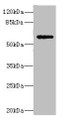 Western blot; All lanes: COX10 antibody at 5.84µg/ml + Mouse heart tissue; Secondary; Goat polyclonal to rabbit IgG at 1/10000 dilution; Predicted band size: 61, 60, 63 kDa; Observed band size: 61 kDa;