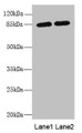 Western blot; All lanes: MAGED1 antibody at 5.52µg/ml; Lane 1: A375 whole cell lysate; Lane 2: 293T whole cell lysate; Secondary; Goat polyclonal to rabbit IgG at 1/10000 dilution; Predicted band size: 87, 92 kDa; Observed band size: 87 kDa