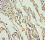 Immunohistochemistry of paraffin-embedded human lung tissue using CAC10794 at dilution of 1:100