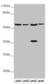 Western blot; All lanes: SLC1A5 antibody at 9.89 µg/ml; Lane 1: Mouse lung tissue; Lane 2: Jurkat whole cell lysate; Lane 3: 293T whole cell lysate; Lane 4: Hela whole cell lysate; Secondary; Goat polyclonal to rabbit IgG at 1/10000 dilution; Predicted band size: 57, 37, 34 kDa; Observed band size: 57, 37 kDa;