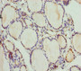 Immunohistochemistry of paraffin-embedded human thyroid tissue using CAC10801 at dilution of 1:100