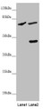 Western blot; All lanes: SLC39A4 antibody at 5 µg/ml; Lane 1: Mouse stomach tissue; Lane 2: 293T whole cell lysate; Secondary; Goat polyclonal to rabbit IgG at 1/10000 dilution; Predicted band size: 69, 67 kDa; Observed band size: 69, 47 kDa;