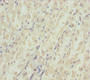 Immunohistochemistry of paraffin-embedded human gastric cancer using CAC10805 at dilution of 1:100