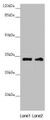 Western blot; All lanes: CENPK antibody at 3.98µg/ml; Lane 1: PC-3 whole cell lysate; Lane 2: 293T whole cell lysate; Secondary; Goat polyclonal to rabbit IgG at 1/10000 dilution; Predicted band size: 32 kDa; Observed band size: 32 kDa;