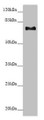 Western blot; All lanes: CEP72 antibody at 3.37µg/ml + Hela whole cell lysate; Secondary; Goat polyclonal to rabbit IgG at 1/10000 dilution; Predicted band size: 72, 22 kDa; Observed band size: 72 kDa