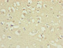 Immunohistochemistry of paraffin-embedded human brain tissue using CAC10815 at dilution of 1:100