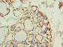 Immunohistochemistry of paraffin-embedded human thyroid tissue using CAC10819 at dilution of 1:100