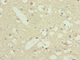 Immunohistochemistry of paraffin-embedded human brain tissue using CAC10820 at dilution of 1:100