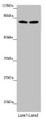 Western blot; All lanes: FBXL5 antibody at 1.51 µg/ml; Lane 1: Mouse lung tissue; Lane 2: Mouse gonadal tissue; Secondary; Goat polyclonal to rabbit IgG at 1/10000 dilution; Predicted band size: 79, 77 kDa; Observed band size: 79, 95 kDa;