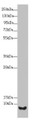 Western blot; All lanes: UQCR10 antibody at 2.02µg/ml + HepG2 whole cell lysate; Secondary; Goat polyclonal to rabbit IgG at 1/10000 dilution; Predicted band size: 8, 7 kDa; Observed band size: 8 kDa