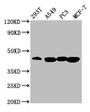 Western Blot; Positive WB detected in: 293T whole cell lysate, A549 whole cell lysate, PC-3 whole cell lysate, MCF-7 whole cell lysate; All lanes: SAV1 antibody at 3.64µg/ml; Secondary; Goat polyclonal to rabbit IgG at 1/50000 dilution; Predicted band size: 45 kDa; Observed band size: 45 kDa