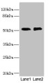 Western blot; All lanes: TMOD1 antibody at 2.84µg/ml; Lane 1: PC-3 whole cell lysate; Lane 2: 293T whole cell lysate; Secondary; Goat polyclonal to rabbit IgG at 1/10000 dilution; Predicted band size: 53, 24 kDa; Observed band size: 53 kDa;