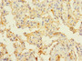 Immunohistochemistry of paraffin-embedded human lung tissue using CAC10849 at dilution of 1:100
