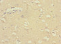 Immunohistochemistry of paraffin-embedded human brain tissue using CAC10850 at dilution of 1:100