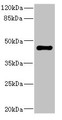 Western blot; All lanes: STRADA antibody IgG at 1.98µg/ml + Rat heart tissue; Secondary; Goat polyclonal to rabbit IgG at 1/10000 dilution; Predicted band size: 49, 39, 44, 34, 42, 35 kDa; Observed band size: 49 kDa;