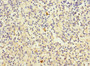 Immunohistochemistry of paraffin-embedded human spleen tissue using CAC10856 at dilution of 1:100