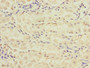 Immunohistochemistry of paraffin-embedded human gastric cancer using CAC10857 at dilution of 1:100