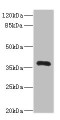 Western blot; All lanes: NTM antibody IgG at 2.42µg/ml + Mouse liver tissue; Secondary; Goat polyclonal to rabbit IgG at 1/10000 dilution; Predicted band size: 38, 35, 40 kDa; Observed band size: 38 kDa