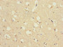 Immunohistochemistry of paraffin-embedded human brain tissue using CAC10864 at dilution of 1:100