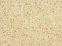 Immunohistochemistry of paraffin-embedded human adrenal gland tissue using CAC10866 at dilution of 1:100