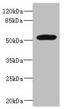 Western blot; All lanes: MARCO antibody at 1.97µg/ml + Jurkat whole cell lysate; Secondary; Goat polyclonal to rabbit IgG at 1/10000 dilution; Predicted band size: 53, 44 kDa; Observed band size: 53 kDa