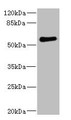 Western blot; All lanes: FCRL2 antibody at 1.78µg/ml + 293T whole cell lysate; Secondary; Goat polyclonal to rabbit IgG at 1/10000 dilution; Predicted band size: 56, 28, 21, 16, 23 kDa; Observed band size: 56 kDa