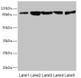 Western blot; All lanes: DSC2 antibody at 3.46µg/ml; Lane 1: Rat heart tissue; Lane 2: A549 whole cell lysate; Lane 3: HepG2 whole cell lysate; Lane 4: Jurkat whole cell lysate; Lane 5: 293T whole cell lysate; Secondary; Goat polyclonal to rabbit IgG at 1/10000 dilution; Predicted band size: 100, 94 kDa; Observed band size: 94 kDa